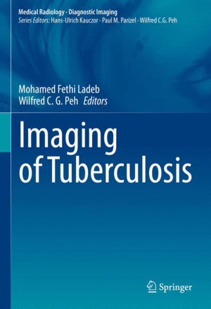 IMAGING OF TUBERCULOSIS