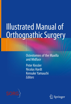 ILLUSTRATED MANUAL OF ORTHOGNATHIC SURGERY. OSTEOTOMIES OF THE MAXILLA AND MIDFACE