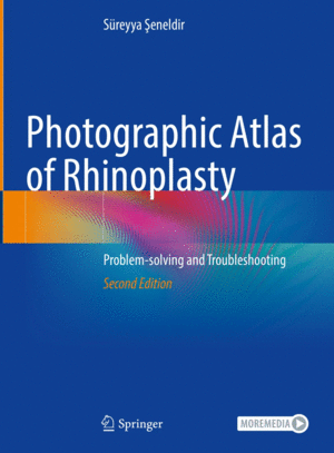 PHOTOGRAPHIC ATLAS OF RHINOPLASTY, PROBLEM-SOLVING AND TROUBLESHOOTING.  2ND EDITION