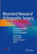 ILLUSTRATED MANUAL OF ORTHOGNATHIC SURGERY. COMBINED BIMAXILLARY OSTEOTOMIES IN THE FACIAL SKELETON