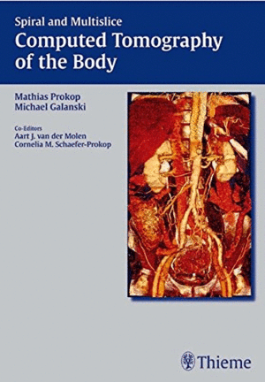 SPIRAL AND MULTISLICE COMPUTED TOMOGRAPHY OF THE BODY