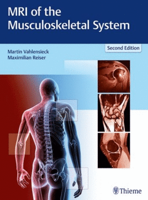 MRI OF THE MUSCULOSKELETAL SYSTEM. 2ND EDITION