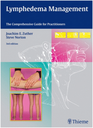 LYMPHEDEMA MANAGEMENT. THE COMPREHENSIVE GUIDE FOR PRACTITIONERS