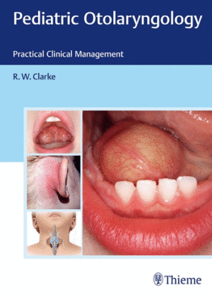 PEDIATRIC OTOLARYNGOLOGY. PRACTICAL CLINICAL MANAGEMENT