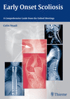 EARLY ONSET SCOLIOSIS. A COMPREHENSIVE GUIDE TO MODERN TREATMENT