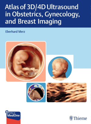 ATLAS OF 3D AND 4D ULTRASOUND IMAGING. PRINCIPLES AND PRACTICE