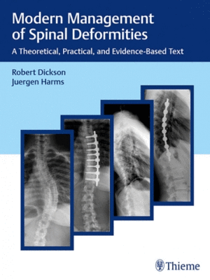 MODERN MANAGEMENT OF SPINAL DEFORMITIES. A THEORETICAL, PRACTICAL, AND EVIDENCE-BASED TEXT
