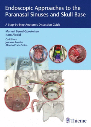 ENDOSCOPIC APPROACHES TO THE PARANASAL SINUSES AND SKULL BASE. A STEP-BY-STEP ANATOMIC DISSECTION GUIDE