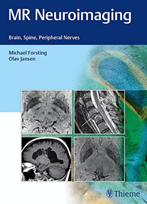 MR NEUROIMAGING: BRAIN, SPINE, PERIPHERAL NERVES
