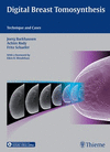 DIGITAL BREAST TOMOSYNTHESIS. TECHNIQUE AND CASES