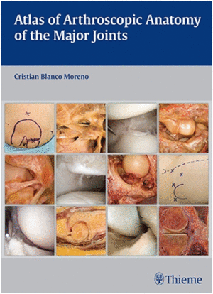 ATLAS OF ARTHROSCOPIC ANATOMY OF THE MAJOR JOINTS