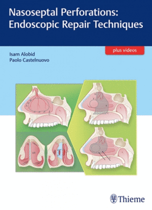 NASOSEPTAL PERFORATIONS: ENDOSCOPIC REPAIR TECHNIQUES + VIDEOS