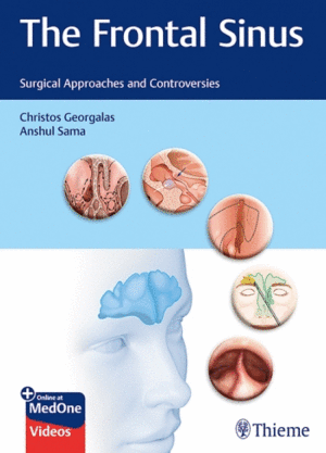 THE FRONTAL SINUS. SURGICAL APPROACHES AND CONTROVERSIES