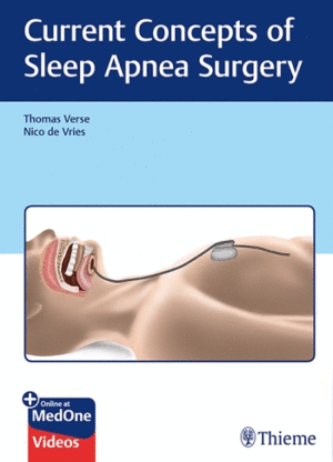 CURRENT CONCEPTS OF SLEEP APNEA SURGERY + ONLINE AT MEDONE VIDEOS