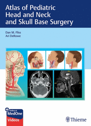 ATLAS OF PEDIATRIC HEAD AND NECK AND SKULL BASE SURGERY