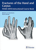 FRACTURES OF THE HAND AND CARPUS. FESSH 2018 INSTRUCTIONAL COURSE BOOK