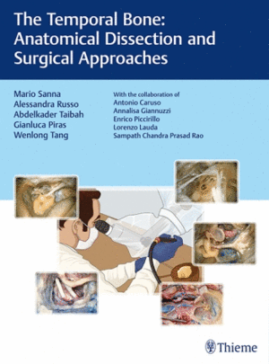 THE TEMPORAL BONE. ANATOMICAL DISSECTION AND SURGICAL APPROACHES