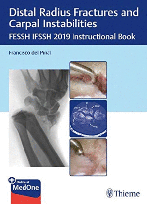 DISTAL RADIUS FRACTURES AND CARPAL INSTABILITIES. FESSH IFSSH 2019 INSTRUCTIONAL BOOK + ONLINE AT ME