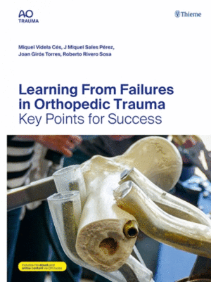 LEARNING FROM FAILURES IN ORTHOPEDIC TRAUMA. KEY POINTS FOR SUCCESS
