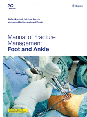 MANUAL OF FRACTURE MANAGEMENT. FOOT AND ANKLE (AO TRAUMA) INCLUDES E-BOOK AND ONLINE CONTENT