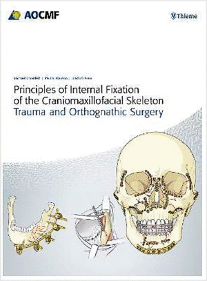 PRINCIPLES OF INTERNAL FIXATION OF THE CRANIOMAXILLOFACIAL SKELETON. TRAUMA AND ORTHOGNATHIC SURGERY