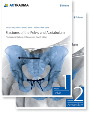 FRACTURES OF THE PELVIS AND ACETABULUM (AO) PRINCIPLES AND METHODS OF MANAGEMENT (2 VOLUME SET). 4TH EDITION