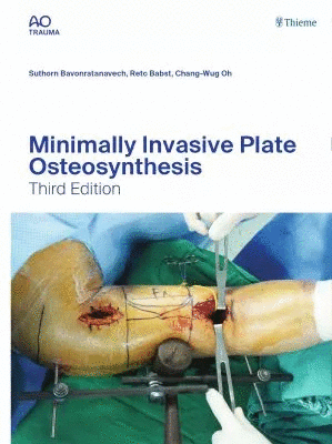 MINIMALLY INVASIVE PLATE OSTEOSYNTHESIS. 3RD EDITION