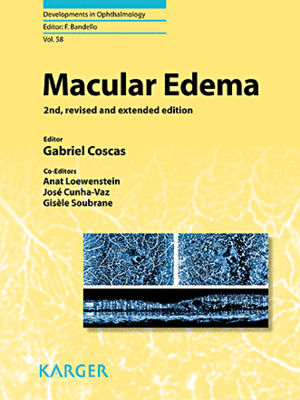 MACULAR EDEMA 2ND EDITION, REVISED AND EXTENDED EDITION