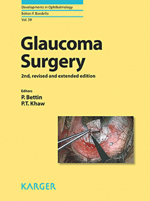 GLAUCOMA SURGERY. 2ND EDITION, REVISED AND EXTENDED EDITION