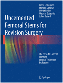 UNCEMENTED FEMORAL STEMS FOR REVISION SURGERY