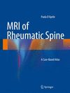 MRI OF RHEUMATIC SPINE