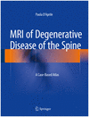 MRI OF DEGENERATIVE DISEASE OF THE SPINE