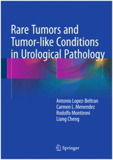 RARE TUMORS AND TUMOR-LIKE CONDITIONS IN UROLOGICAL PATHOLOGY