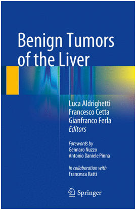 BENIGN TUMORS OF THE LIVER