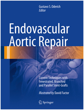 ENDOVASCULAR AORTIC REPAIR. CURRENT TECHNIQUES WITH FENESTRATED, BRANCHED AND PARALLEL STENT-GRAFTS