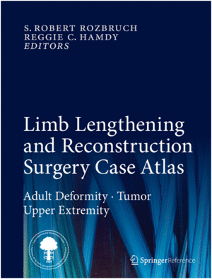LIMB LENGTHENING AND RECONSTRUCTION SURGERY CASE ATLAS. ADULT DEFORMITY - TUMOR - UPPER EXTREMITIES