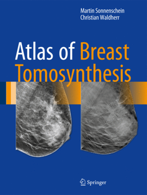 ATLAS OF BREAST TOMOSYNTHESIS. IMAGING FINDINGS AND IMAGE-GUIDED INTERVENTIONS