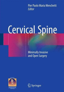CERVICAL SPINE. MINIMALLY INVASIVE AND OPEN SURGERY