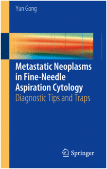METASTATIC NEOPLASMS IN FINE-NEEDLE ASPIRATION CYTOLOGY. DIAGNOSTIC TIPS AND TRAPS