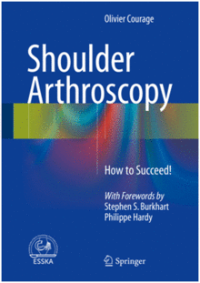 SHOULDER ARTHROSCOPY. HOW TO SUCCEED