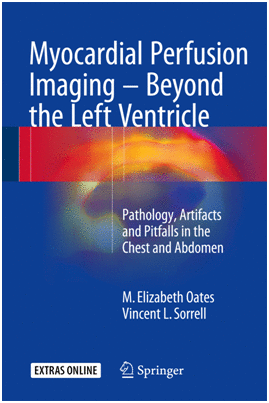MYOCARDIAL PERFUSION IMAGING - BEYOND THE LEFT VENTRICLE. PATHOLOGY, ARTIFACTS AND PITFALLS IN THE CHEST AND ABDOMEN