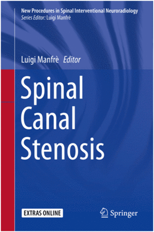 SPINAL CANAL STENOSIS (NEW PROCEDURES IN SPINAL INTERVENTIONAL NEURORADIOLOGY)