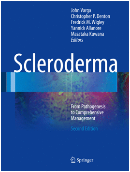 SCLERODERMA. FROM PATHOGENESIS TO COMPREHENSIVE MANAGEMENT. 2ND EDITION