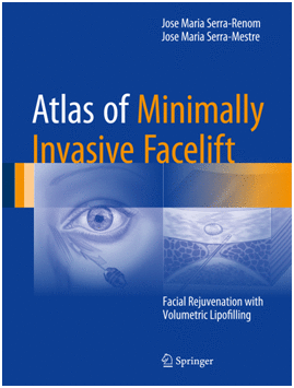 ATLAS OF MINIMALLY INVASIVE FACELIFT. FACIAL REJUVENATION WITH VOLUMETRIC LIPOFILLING