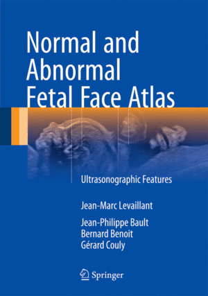 NORMAL AND ABNORMAL FETAL FACE ATLAS. ULTRASONOGRAPHIC FEATURES