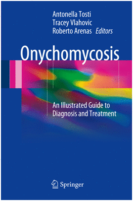 ONYCHOMYCOSIS. AN ILLUSTRATED GUIDE TO DIAGNOSIS AND TREATMENT