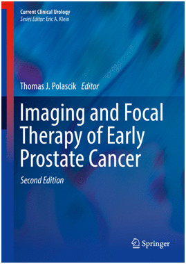 IMAGING AND FOCAL THERAPY OF EARLY PROSTATE CANCER. 2ND EDITION