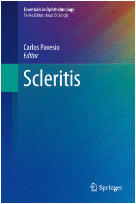 SCLERITIS