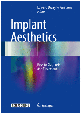 IMPLANT AESTHETICS. KEYS TO DIAGNOSIS AND TREATMENT + ONLINE VIDEOS