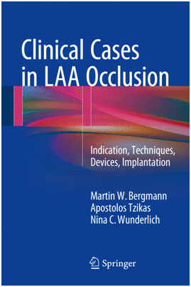 CLINICAL CASES IN LAA OCCLUSION. INDICATION, TECHNIQUES, DEVICES, IMPLANTATION